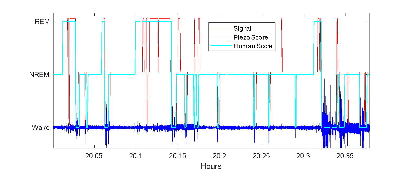 EEG Validation Study - Signal Solutions